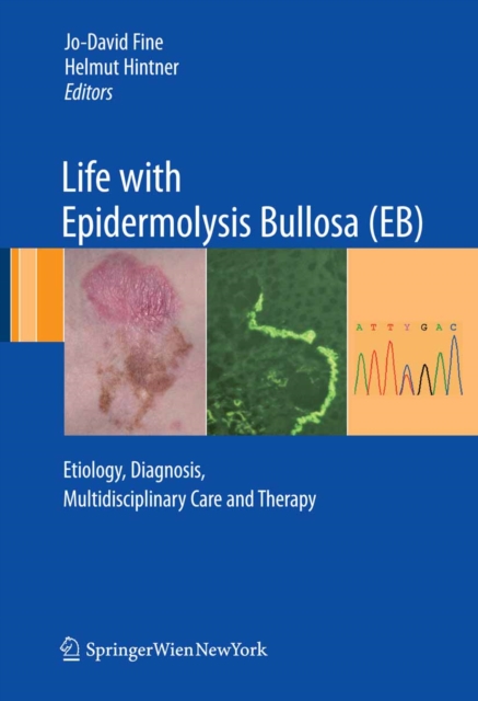 Life with Epidermolysis Bullosa (EB) : Etiology, Diagnosis, Multidisciplinary Care and Therapy, PDF eBook