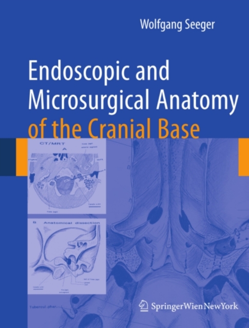 Endoscopic and microsurgical anatomy of the cranial base, PDF eBook