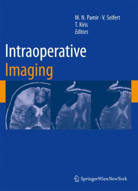 Intraoperative Imaging, Hardback Book