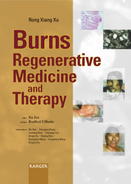 Burns Regenerative Medicine and Therapy, PDF eBook