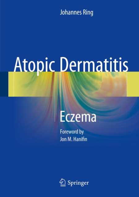 Atopic Dermatitis : Eczema, PDF eBook