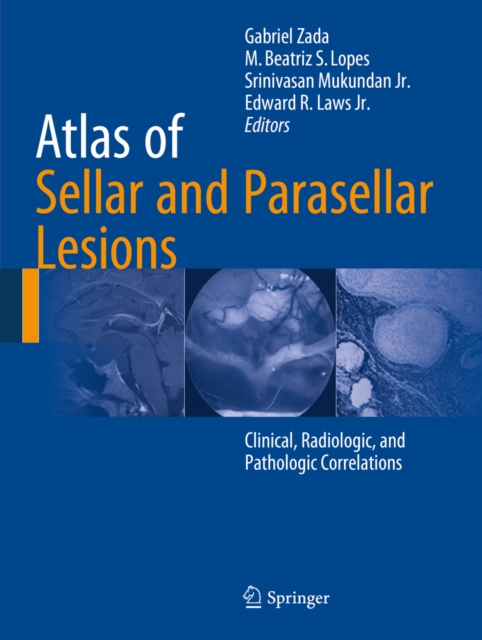 Atlas of Sellar and Parasellar Lesions : Clinical, Radiologic, and Pathologic Correlations, PDF eBook