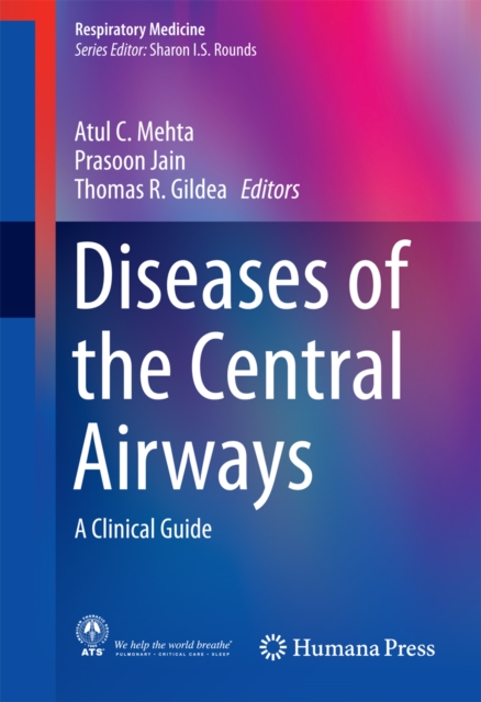 Diseases of the Central Airways : A Clinical Guide, PDF eBook