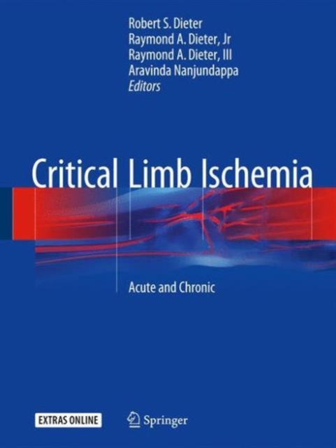 Critical Limb Ischemia : Acute and Chronic, Hardback Book