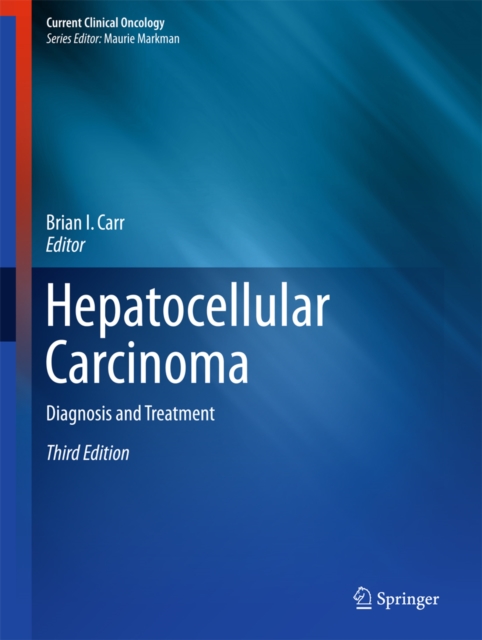 Hepatocellular Carcinoma : Diagnosis and Treatment, PDF eBook