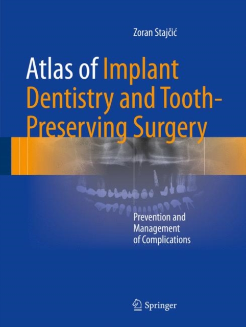 Atlas of Implant Dentistry and Tooth-Preserving Surgery : Prevention and Management of Complications, Hardback Book