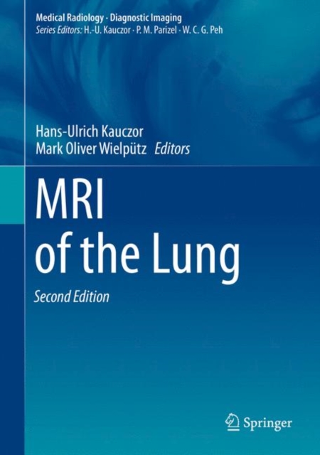 MRI of the Lung, Hardback Book