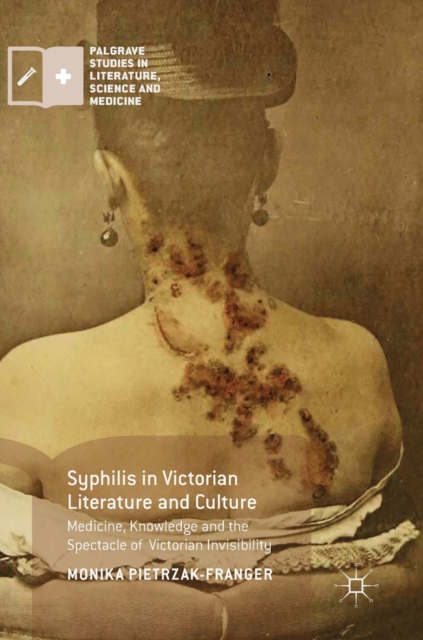 Syphilis in Victorian Literature and Culture : Medicine, Knowledge and the Spectacle of Victorian Invisibility, Hardback Book