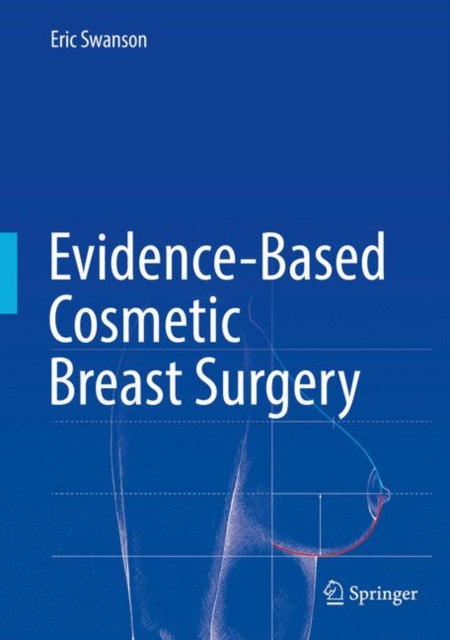 Evidence-Based Cosmetic Breast Surgery, Hardback Book