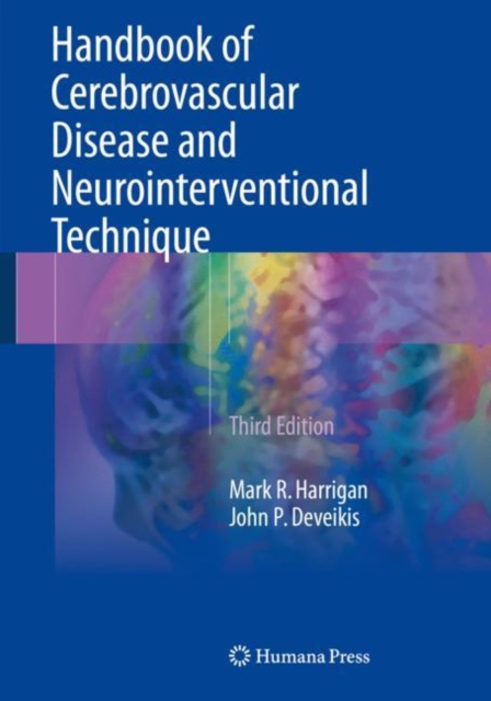 Handbook of Cerebrovascular Disease and Neurointerventional Technique, Paperback / softback Book