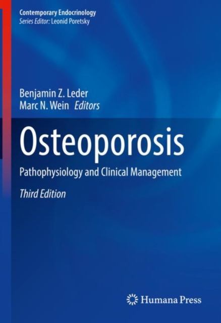 Osteoporosis : Pathophysiology and Clinical Management, Hardback Book