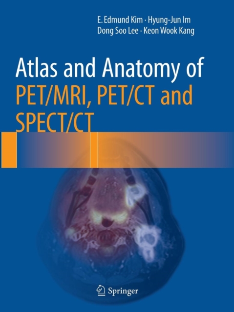Atlas and Anatomy of PET/MRI, PET/CT and SPECT/CT, Paperback / softback Book