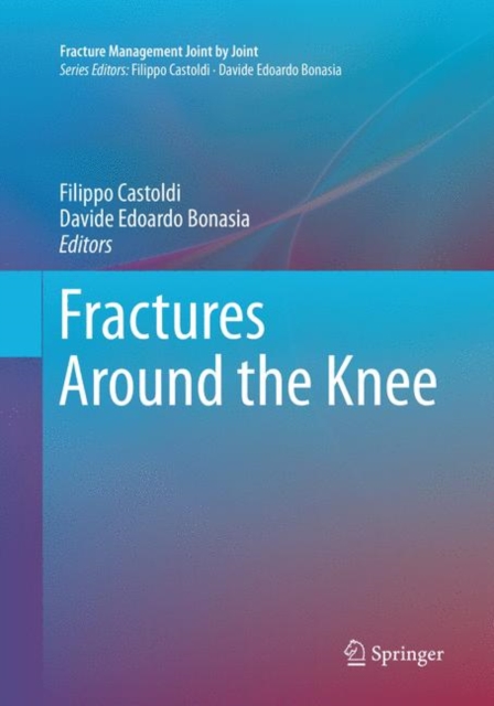 Fractures Around the Knee, Paperback / softback Book