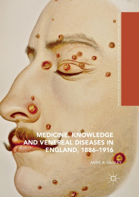 Medicine, Knowledge and Venereal Diseases in England, 1886-1916, Paperback / softback Book