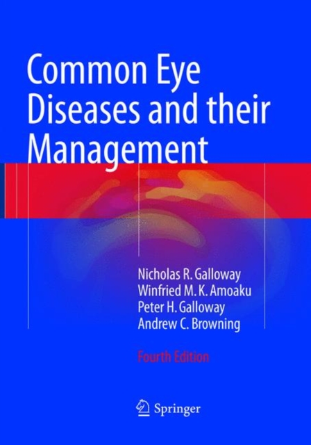 Common Eye Diseases and their Management, Paperback / softback Book