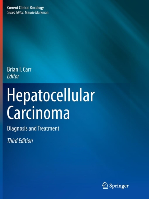 Hepatocellular Carcinoma : Diagnosis and Treatment, Paperback / softback Book