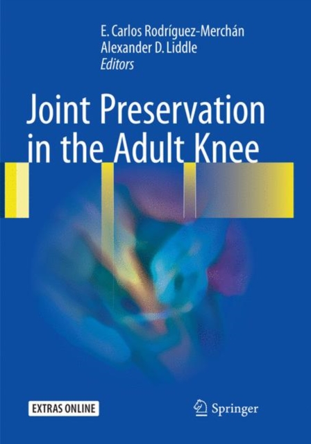 Joint Preservation in the Adult Knee, Paperback / softback Book