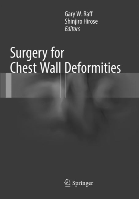 Surgery for Chest Wall Deformities, Paperback / softback Book