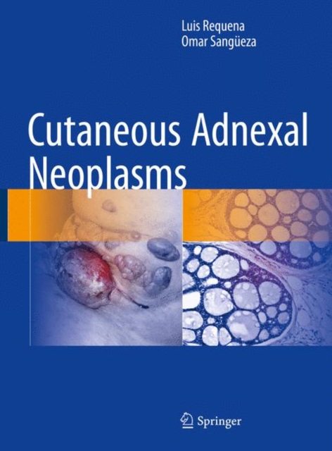 Cutaneous Adnexal Neoplasms, Paperback / softback Book