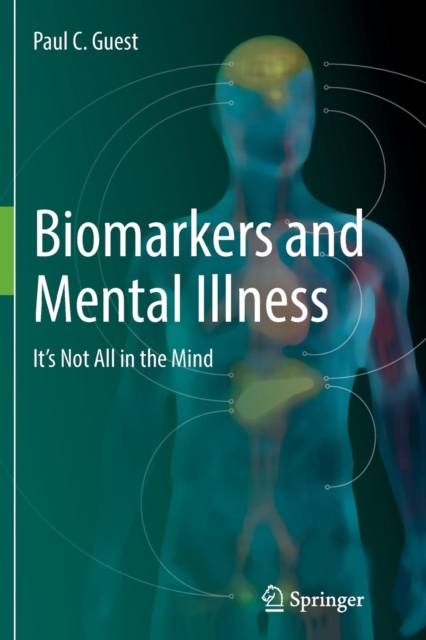 Biomarkers and Mental Illness : It's Not All in the Mind, Paperback / softback Book