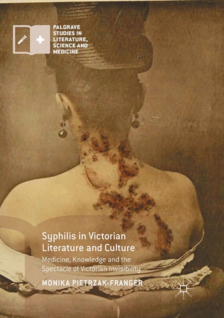 Syphilis in Victorian Literature and Culture : Medicine, Knowledge and the Spectacle of Victorian Invisibility, Paperback / softback Book