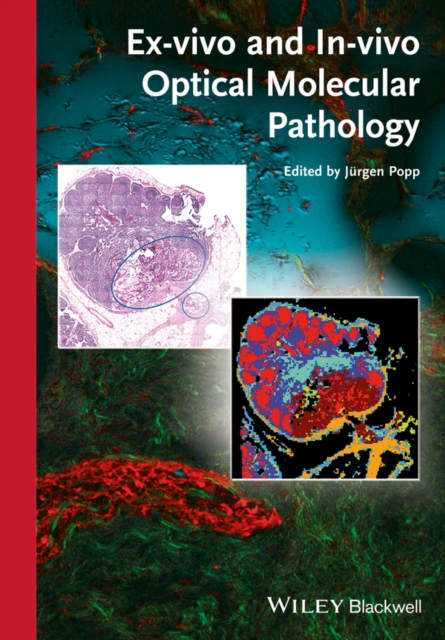 Ex-vivo and In-vivo Optical Molecular Pathology, Hardback Book