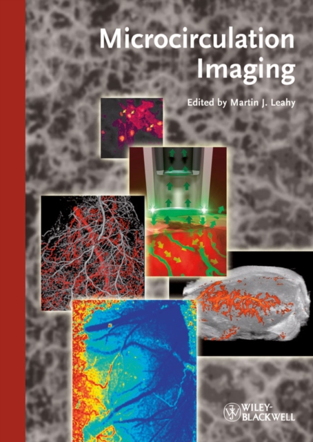 Microcirculation Imaging, PDF eBook