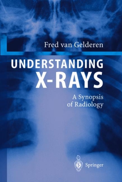 Understanding X-Rays : A Synopsis of Radiology, Hardback Book