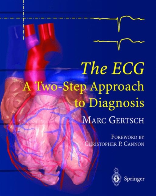 The ECG : A Two-Step Approach to Diagnosis, Hardback Book