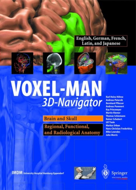 VOXEL-MAN 3D-navigator : Brain and Skull, Regional, Functional, and Radiological Anatomy Brain and Skull, Regional, Functional and Radiological Anatomy, CD-ROM Book