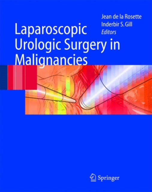 Laparoscopic Urologic Surgery in Malignancies, Hardback Book