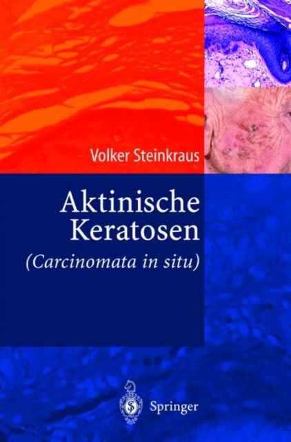 Aktinische Keratosen (Carcinomata in Situ), Hardback Book