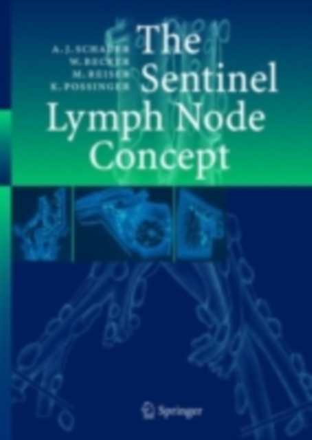 The Sentinel Lymph Node Concept, PDF eBook