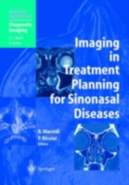 Imaging in Treatment Planning for Sinonasal Diseases, PDF eBook