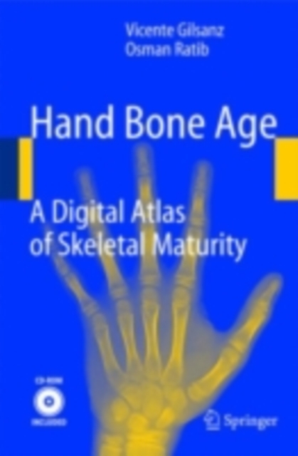 Hand Bone Age : A Digital Atlas of Skeletal Maturity, PDF eBook