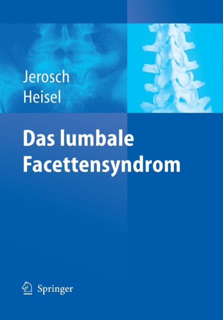 Das lumbale Facettensyndrom, Paperback / softback Book