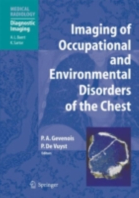 Imaging of Occupational and Environmental Disorders of the Chest, PDF eBook