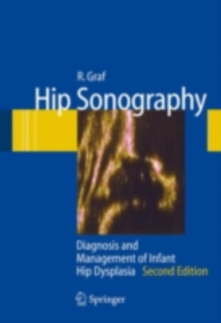 Hip Sonography : Diagnosis and Management of Infant Hip Dysplasia, PDF eBook