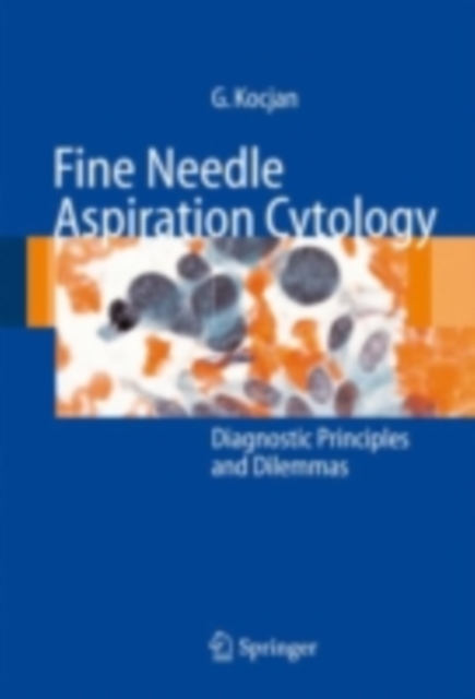 Fine Needle Aspiration Cytology : Diagnostic Principles and Dilemmas, PDF eBook