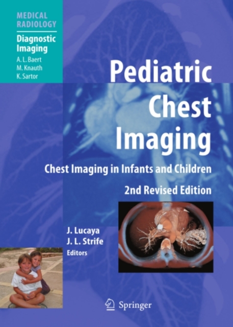 Pediatric Chest Imaging : Chest Imaging in Infants and Children, PDF eBook