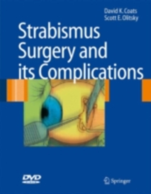 Strabismus Surgery and its Complications, PDF eBook