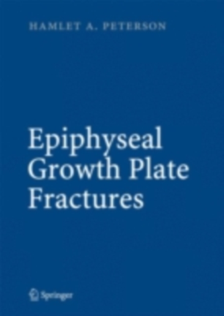 Epiphyseal Growth Plate Fractures, PDF eBook