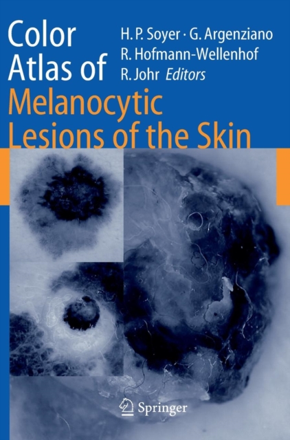 Color Atlas of Melanocytic Lesions of the Skin, Hardback Book