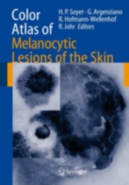 Color Atlas of Melanocytic Lesions of the Skin, PDF eBook