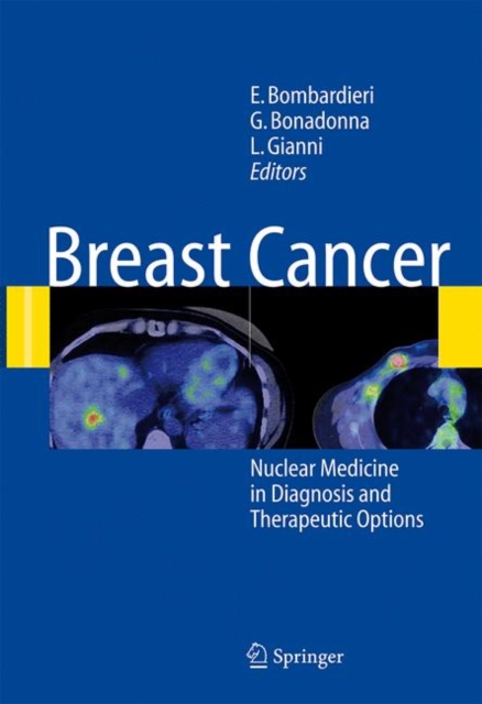 Breast Cancer : Nuclear Medicine in Diagnosis and Therapeutic Options, Hardback Book