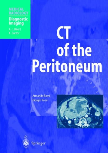 CT of the Peritoneum, Hardback Book