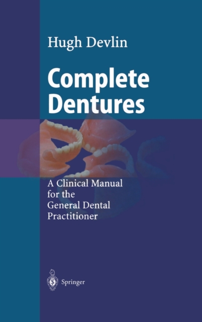 Complete Dentures, Hardback Book