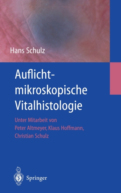 Auflichtmikroskopische Vitalhistologie : Dermatologischer Leitfaden, Hardback Book