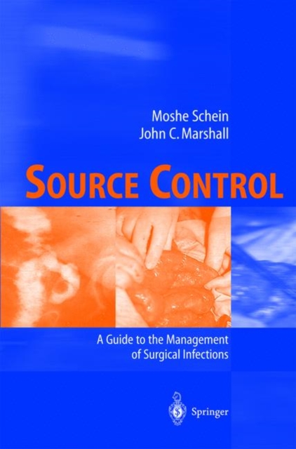Source Control : A Guide to the Management of Surgical Infections, Paperback / softback Book