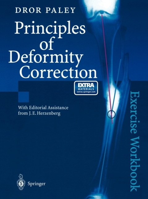 Principles of Deformity Correction : Exercise Workbook, Paperback / softback Book